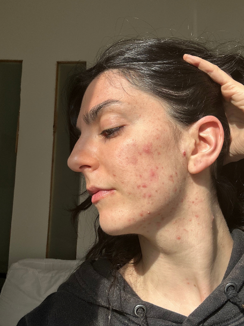 I’ve struggled (and still struggle) with hormonal issues, acne, navigating a late diagnosis of ADHD, PMDD, and the intensity of living in NYC. Even as someone who connects easily to her body, I am naturally a very heady person.