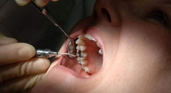 Customer Effort - it's like pulling teeth!