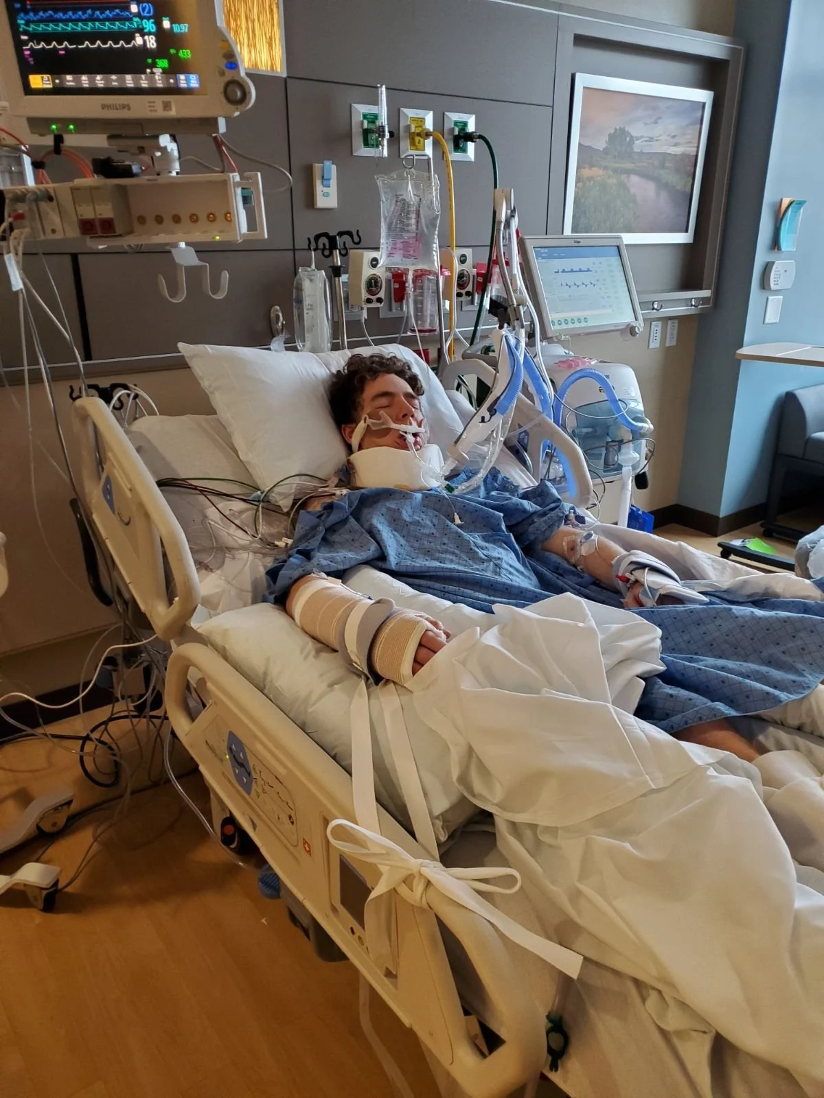 A patient in a hospital bed connected to medical equipment, with monitors displaying vital signs, in a hospital room.