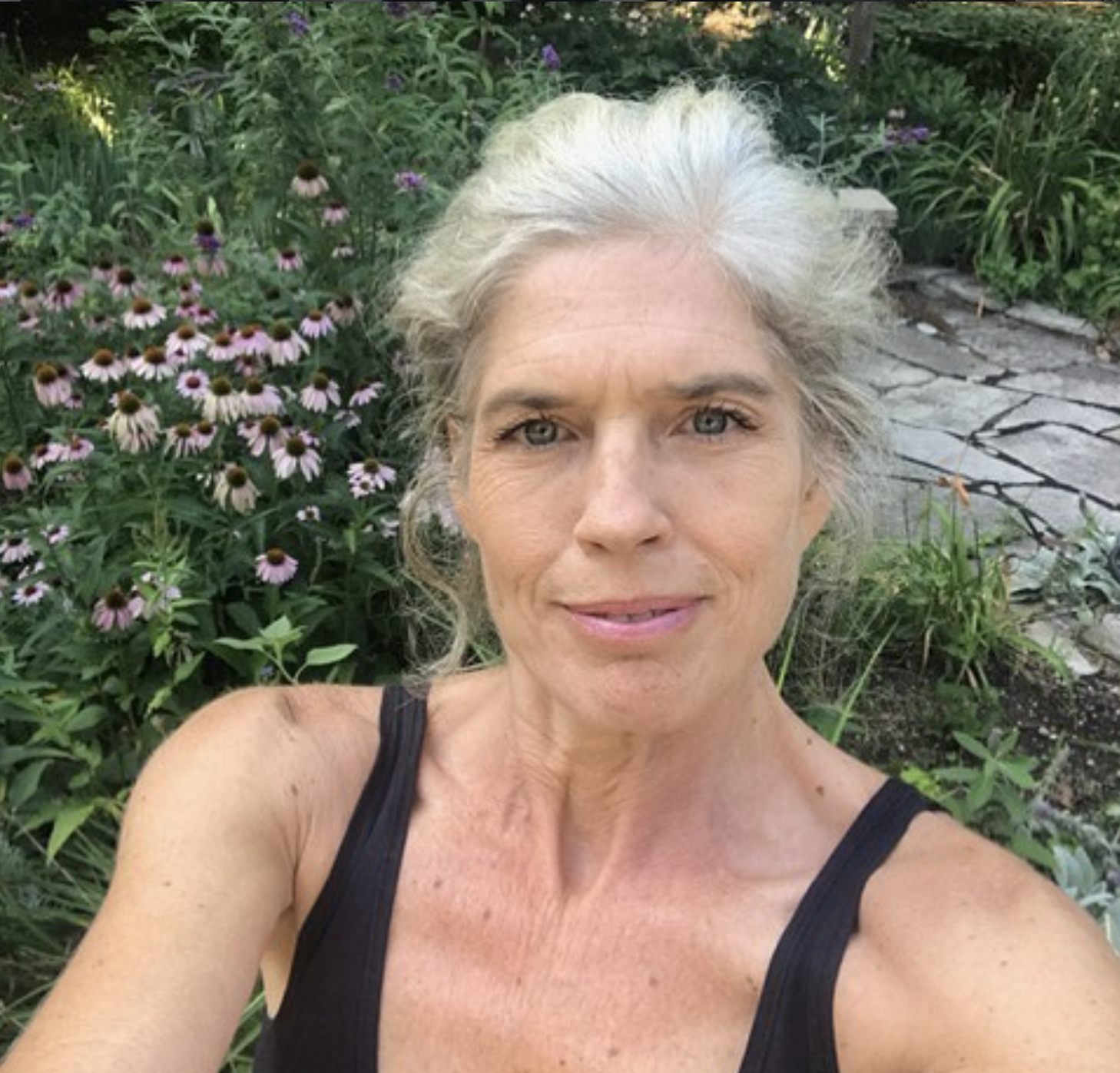Shelley’s Story