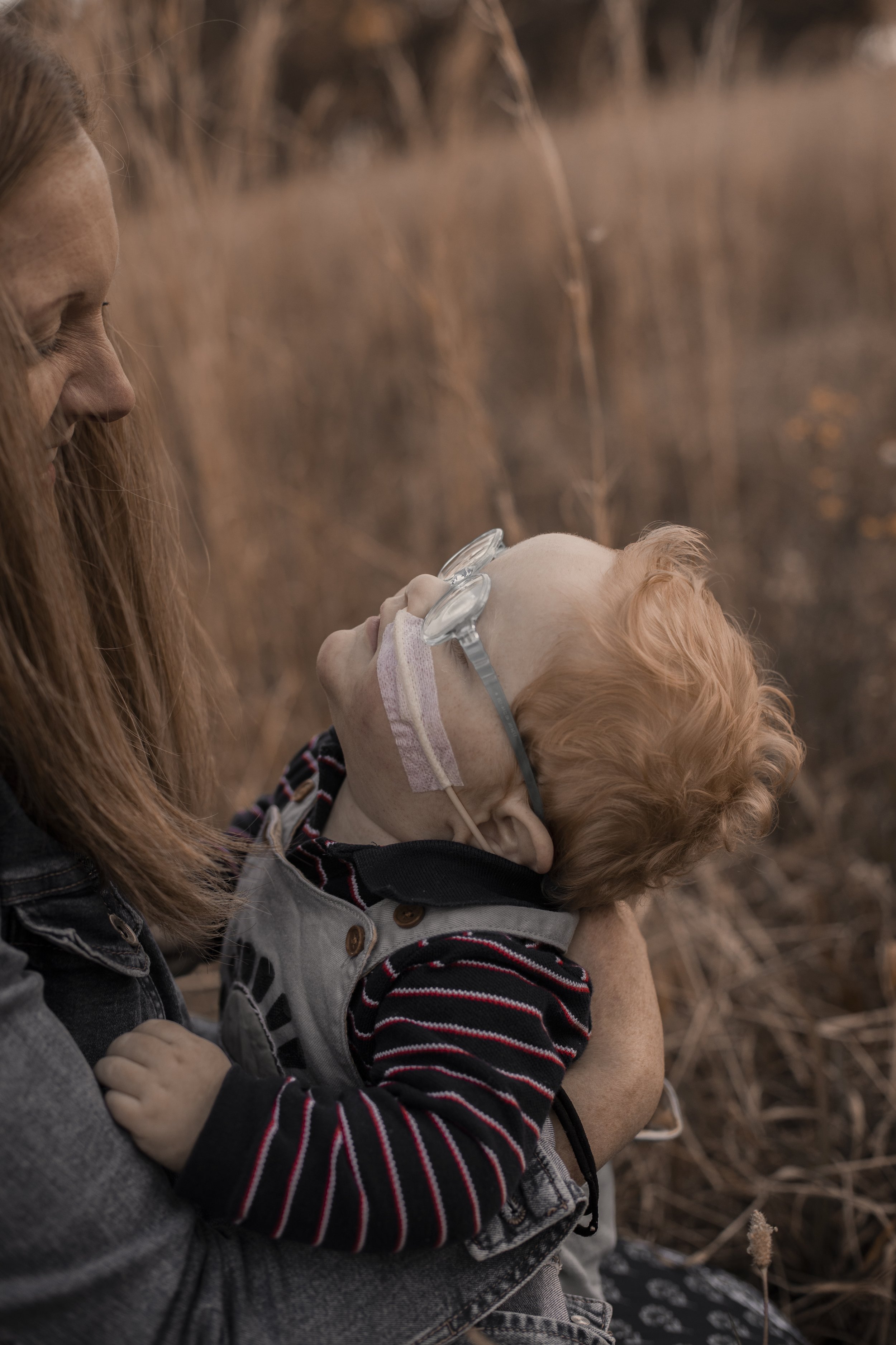 A mother and child communicating nonverbally. Baby has a nasogastric tube and a disability.