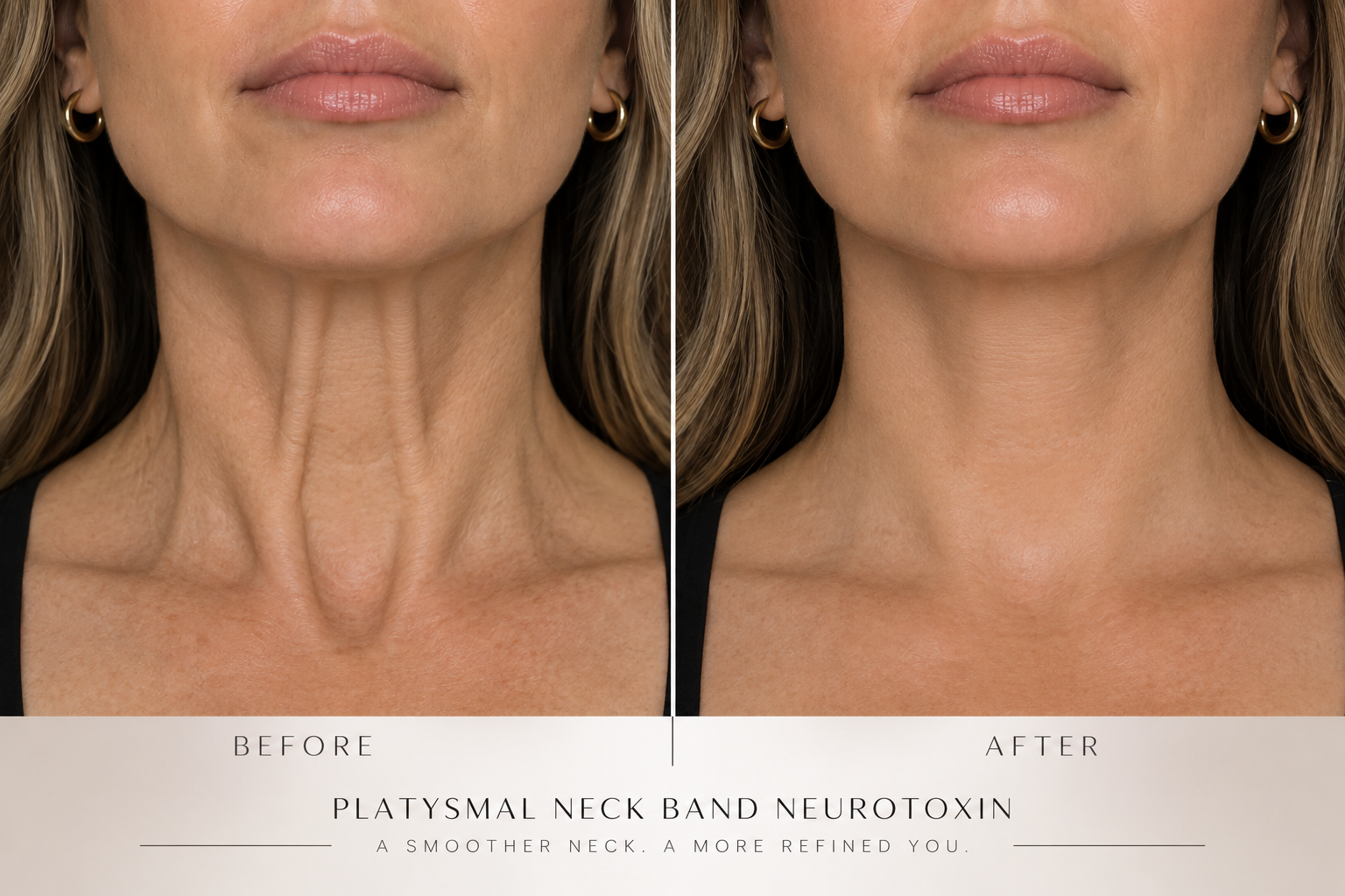 Neck Band TOX