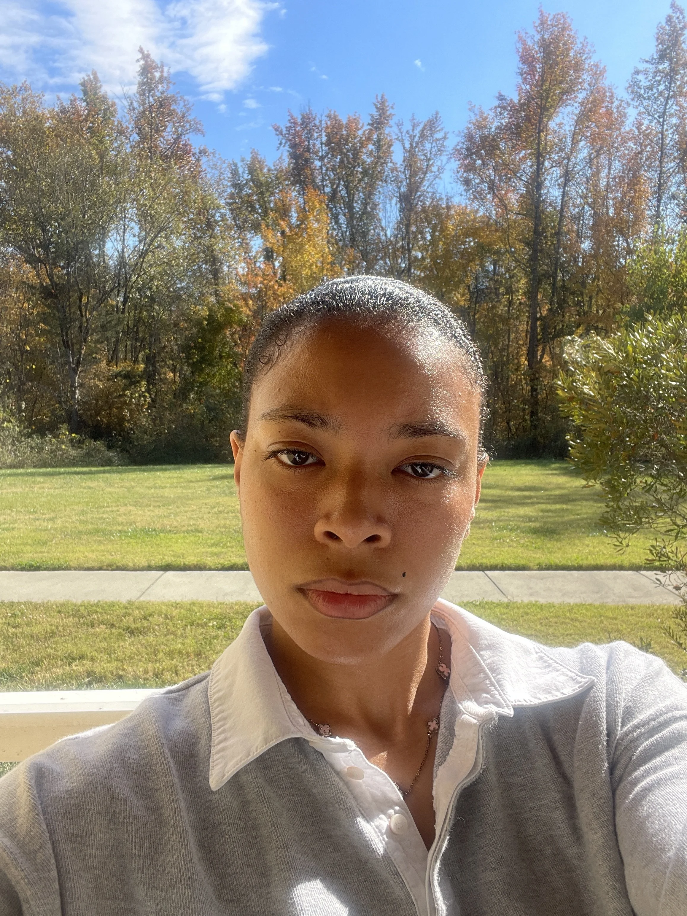 Close-up SHY's, showing part of their forehead, eyes, nose, and mouth, outdoors with green grass, trees with fall foliage, and a blue sky in the background.