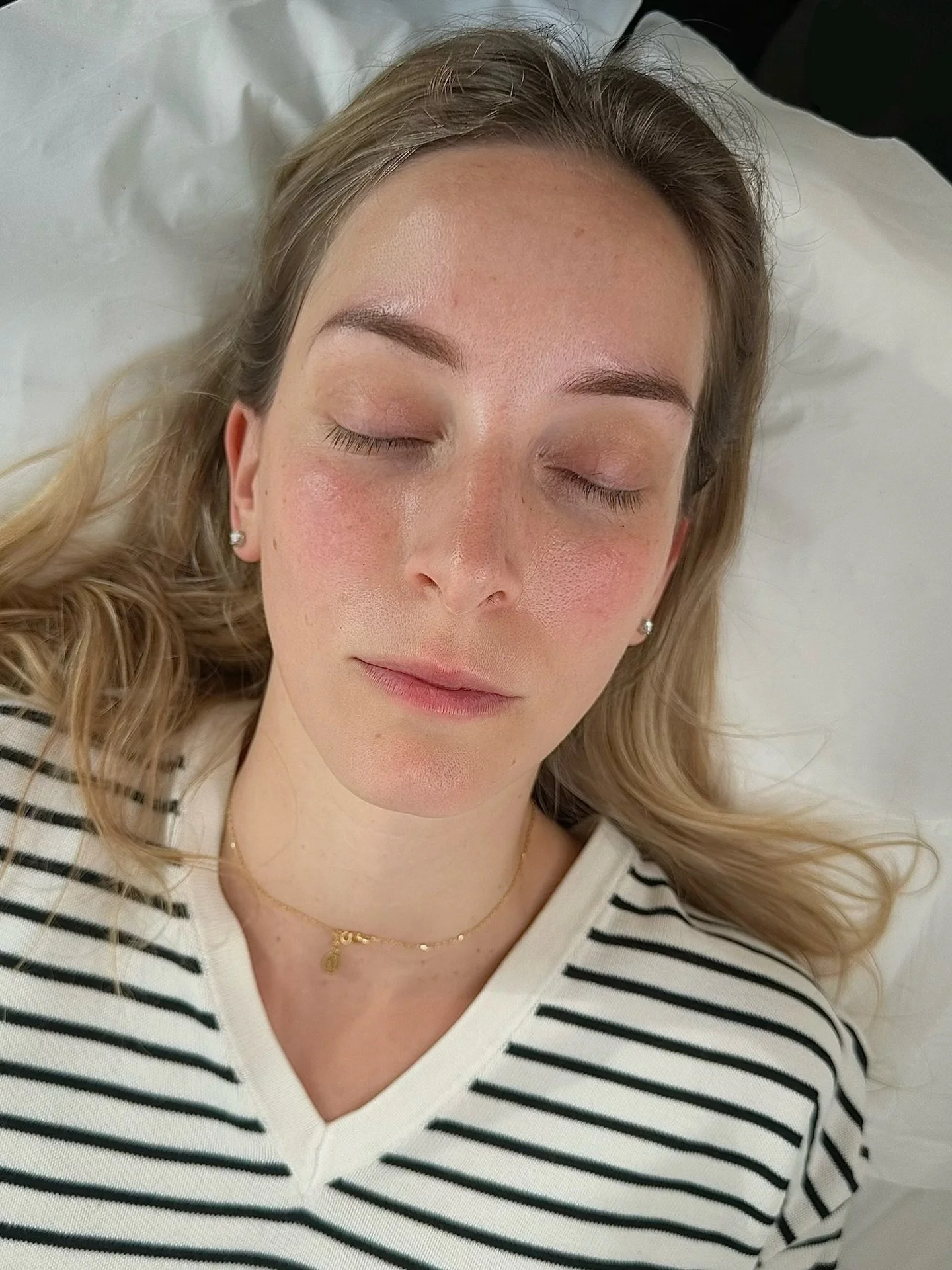Fresh Powder Brows 🤍✨

Immediately after treatment, the brows are intentionally a little more defined.

As the skin heals, the pigment naturally softens, creating elegant, effortless brows that frame your face, not overpower it.

Trust me, naturalne