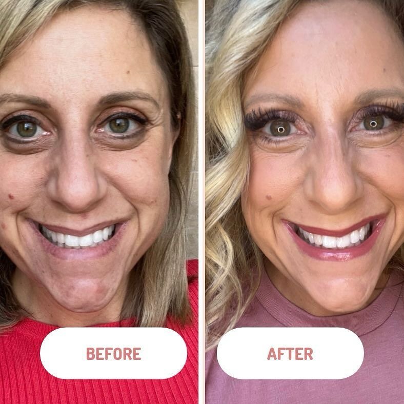 Emily Seagren before and after Beauty Society skincare and wellness products.