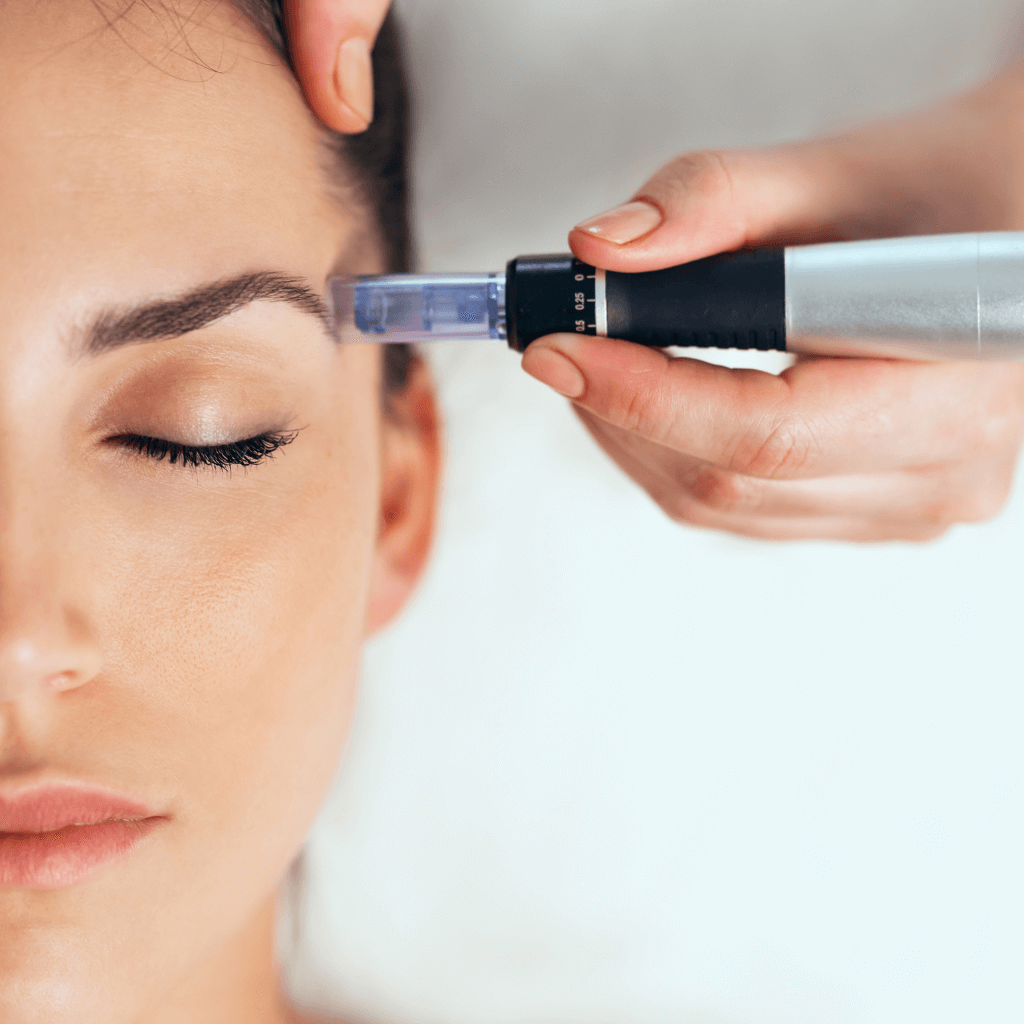 Dermapen - Microneedling