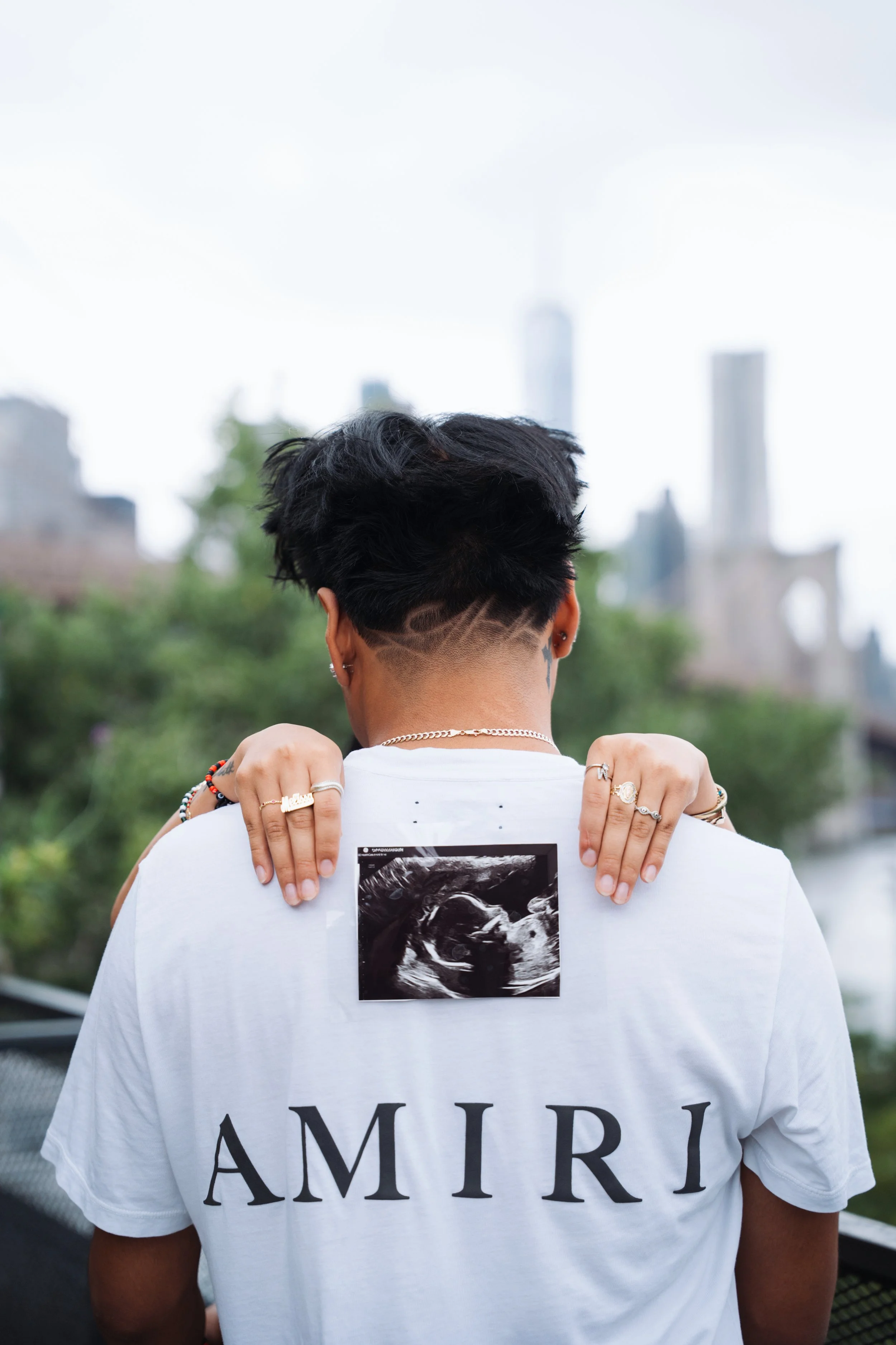 Person with short dark hair, wearing a white T-shirt with the word 'AMIRI' printed on the back, holding ultrasound image in front of their back, outdoors with city skyline and skyscrapers in the background.