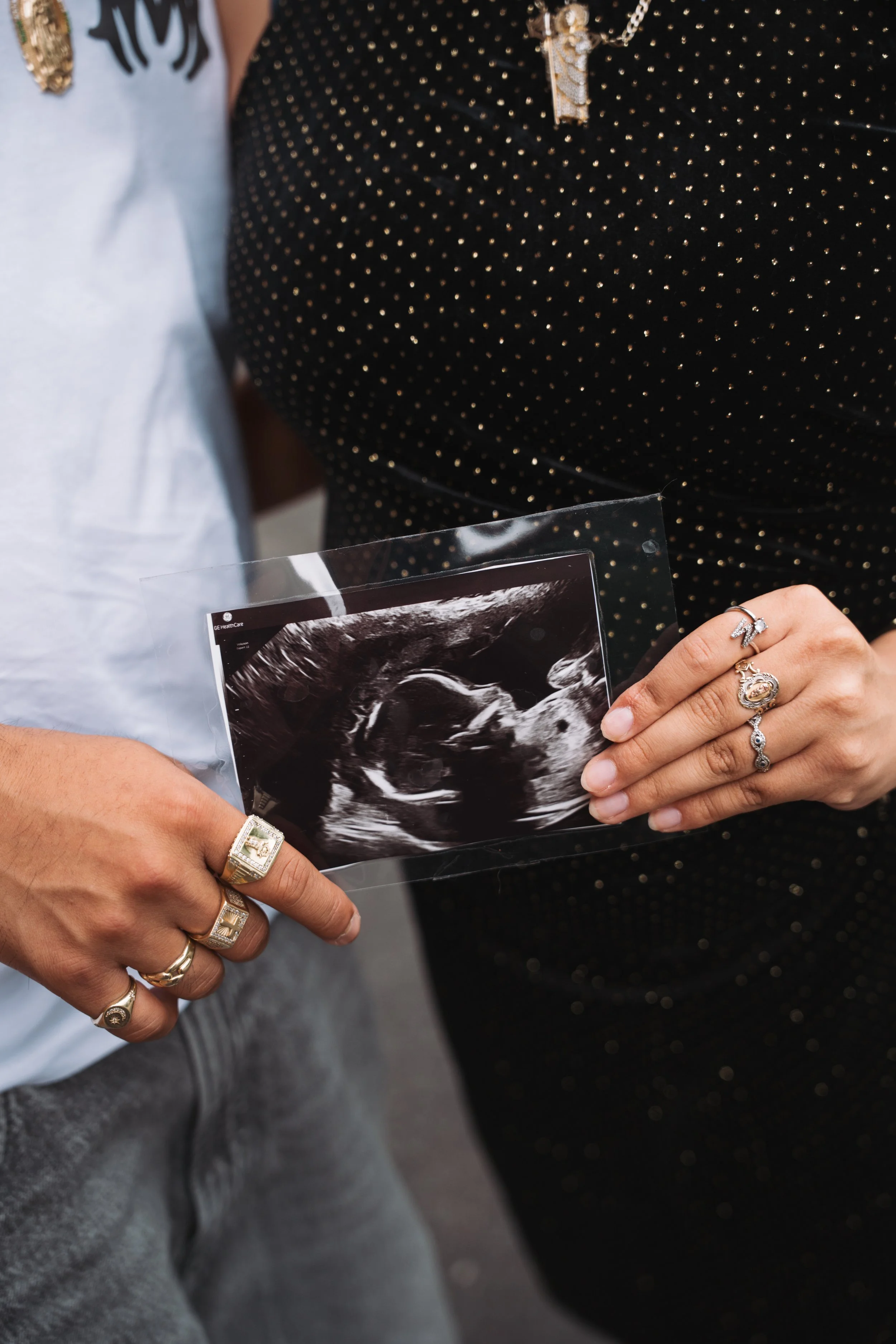 People holding an ultrasound image of a baby.