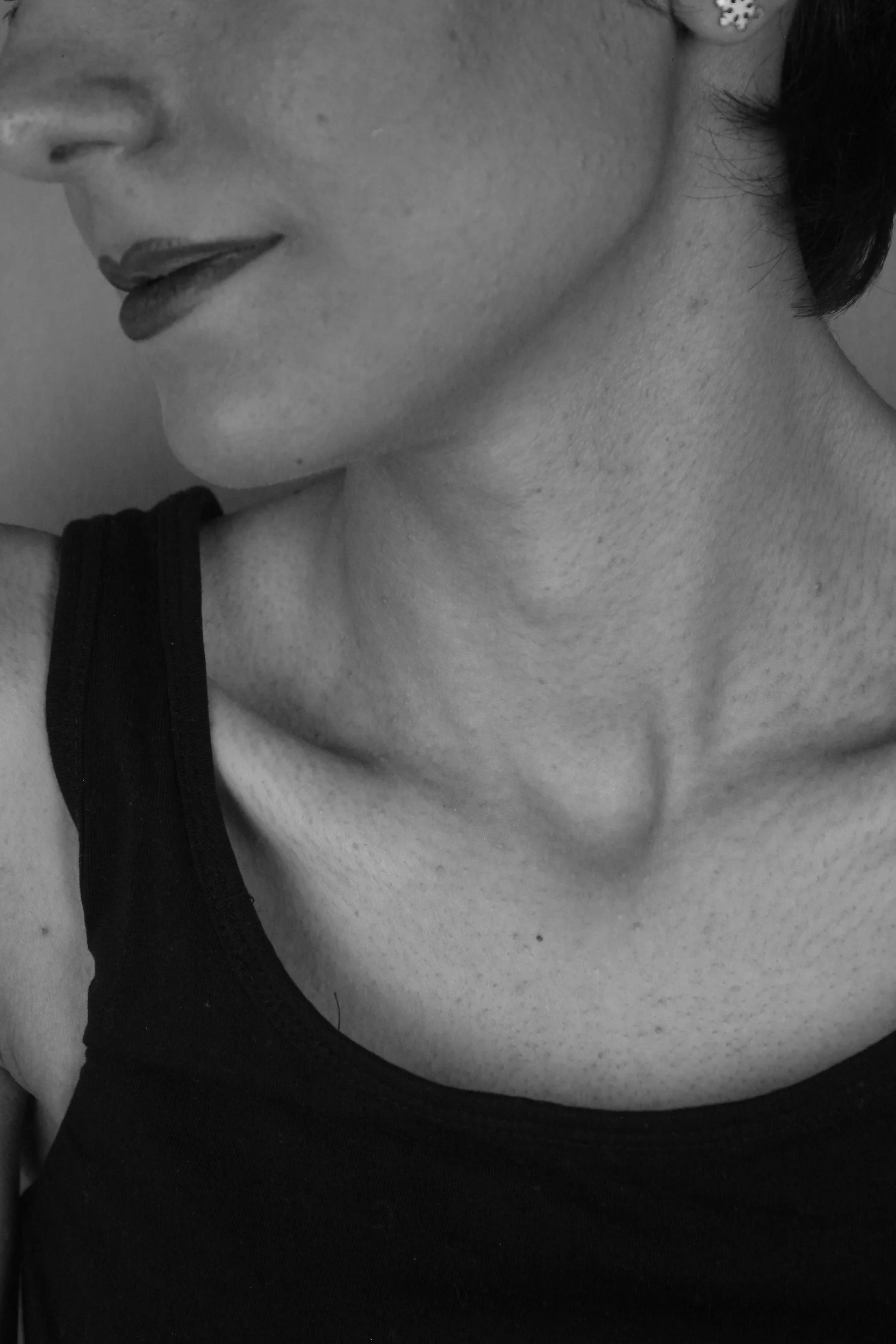 nefertiti-lift-jawline-neck-contouring-houston-lush-beauty-break.jpg