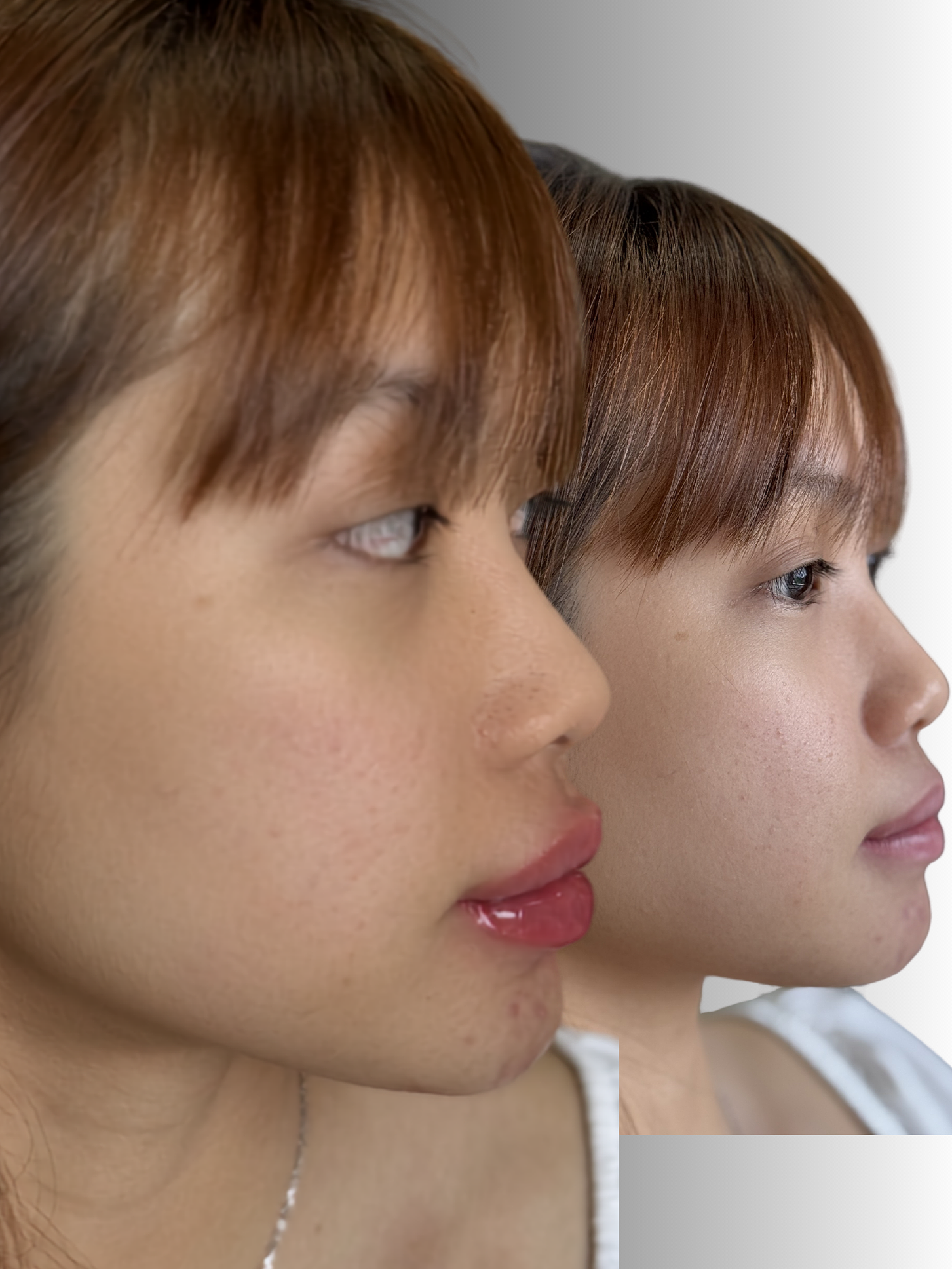 Close-up of two women with side profiles, both with reddish-brown hair, makeup, and natural skin, shows lip fillers natural and no duck lips.