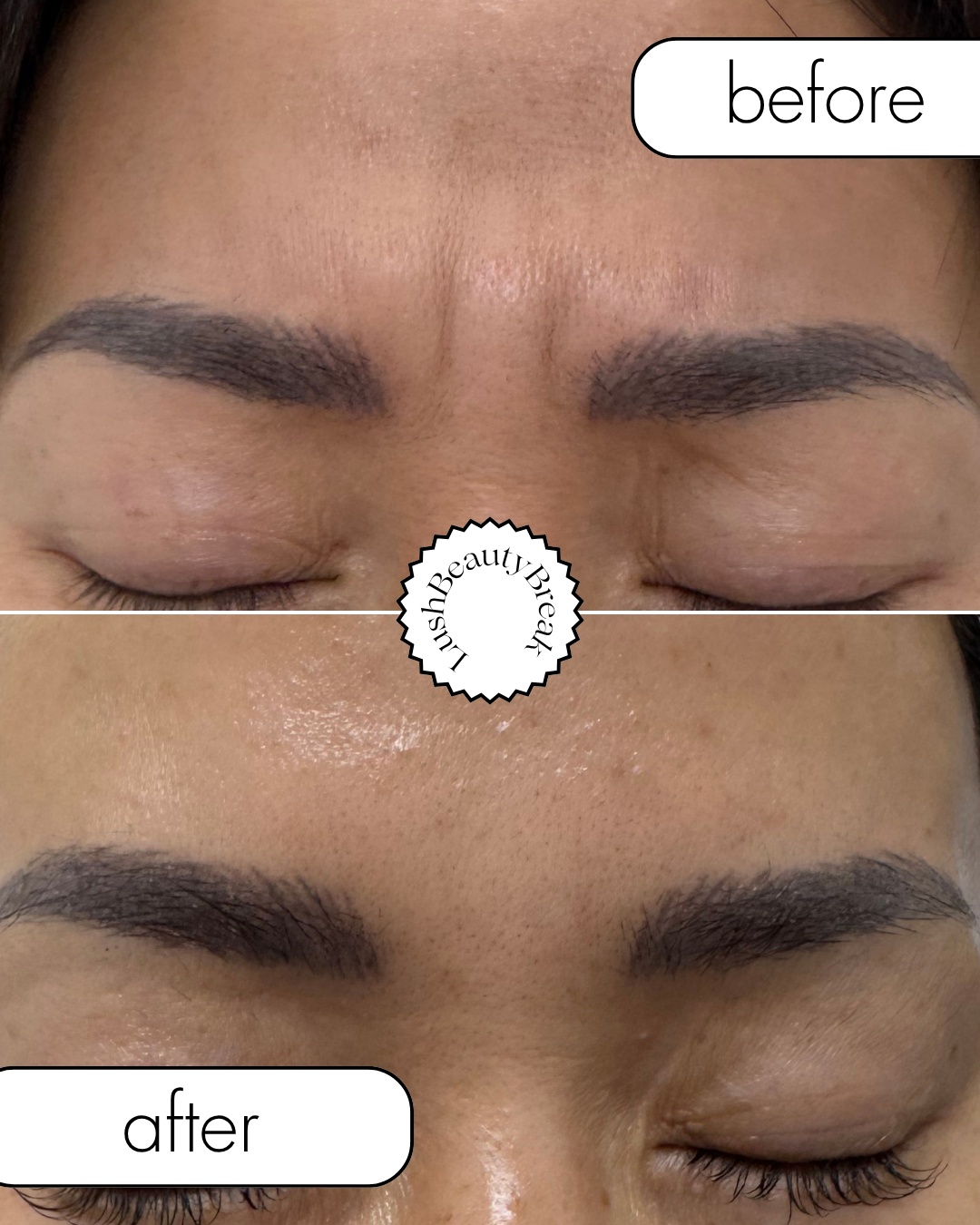 Close-up of a person's forehead and eyebrows, showing a before-and-after comparison of eyebrow grooming or permanent makeup. The top half labeled 'before' shows sparse, uneven eyebrows, while the bottom half labeled 'after' shows fuller, well-shaped 