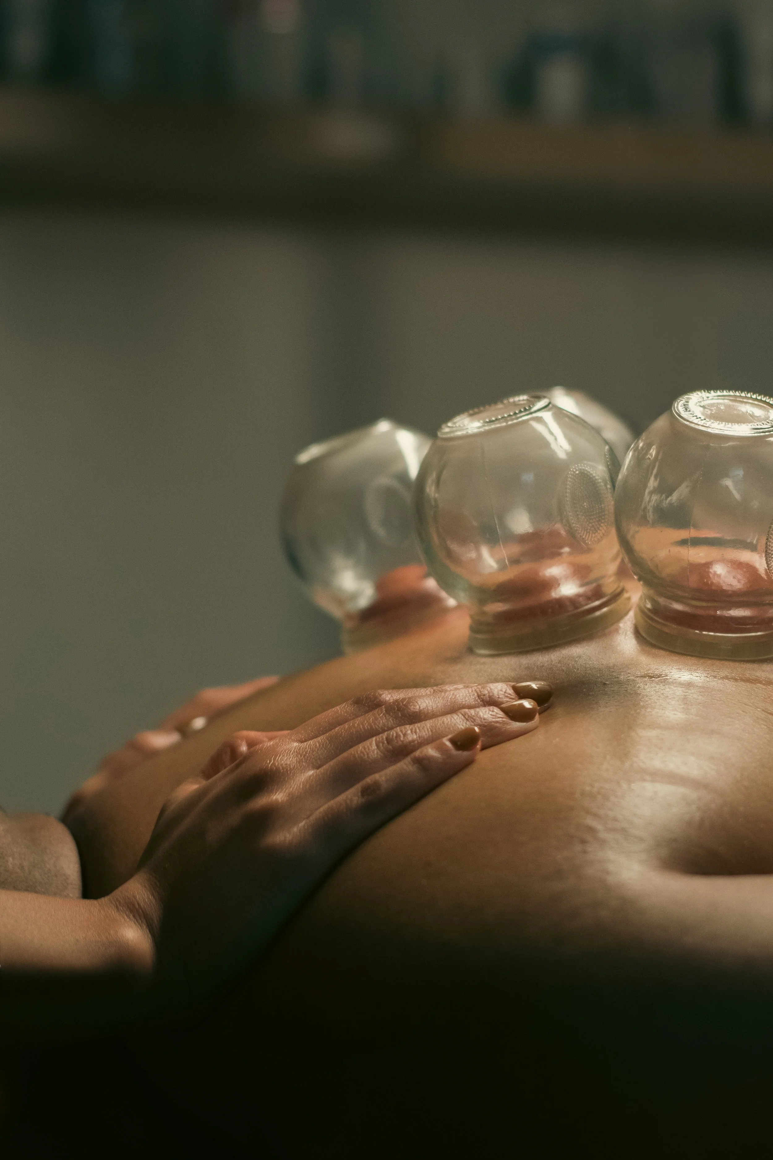 Close-up of hands massaging a person's back with glass cups used for cupping therapy.
