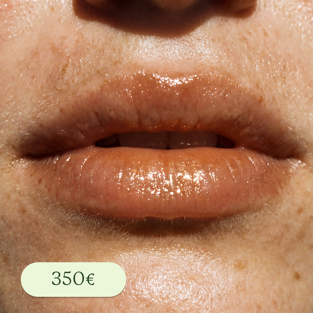 Primer plano de labios con brillo en una piel con manchas y poros visibles, con una etiqueta que indica el precio de 350 euros.