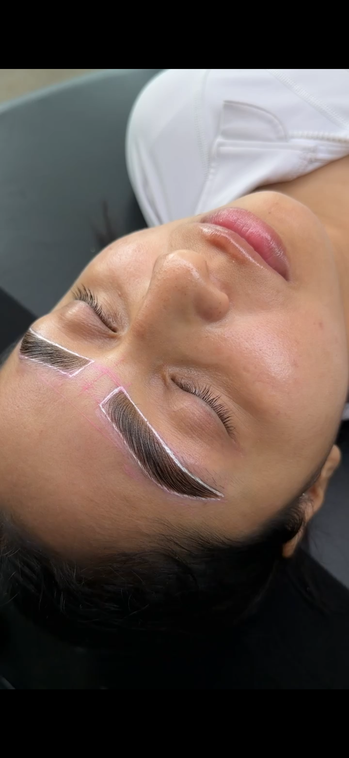 Close-up of a woman lying with her eyes closed, undergoing a cosmetic eyebrow microblading procedure. Medical marks and outlines are drawn on her forehead, indicating the area for the semi-permanent makeup.