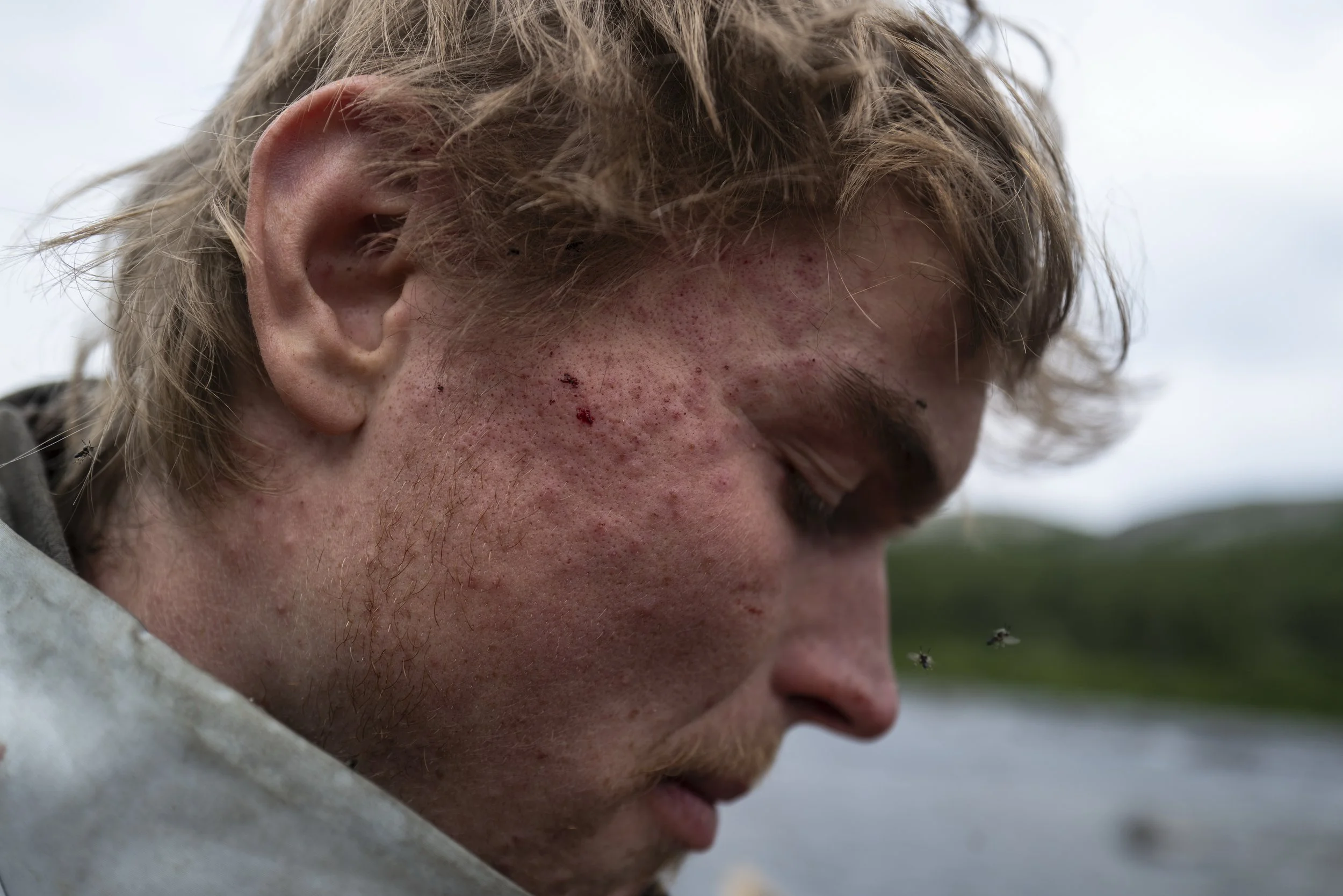 Miles Gordon, a chef from Toronto and film student in Vancouver, eats a snack after a portage during a 45-day, 700-kilometer expedition through northern Quebec on Aug. 2, 2025. Gordon’s face is marked by bites from black flies, which were a constant 
