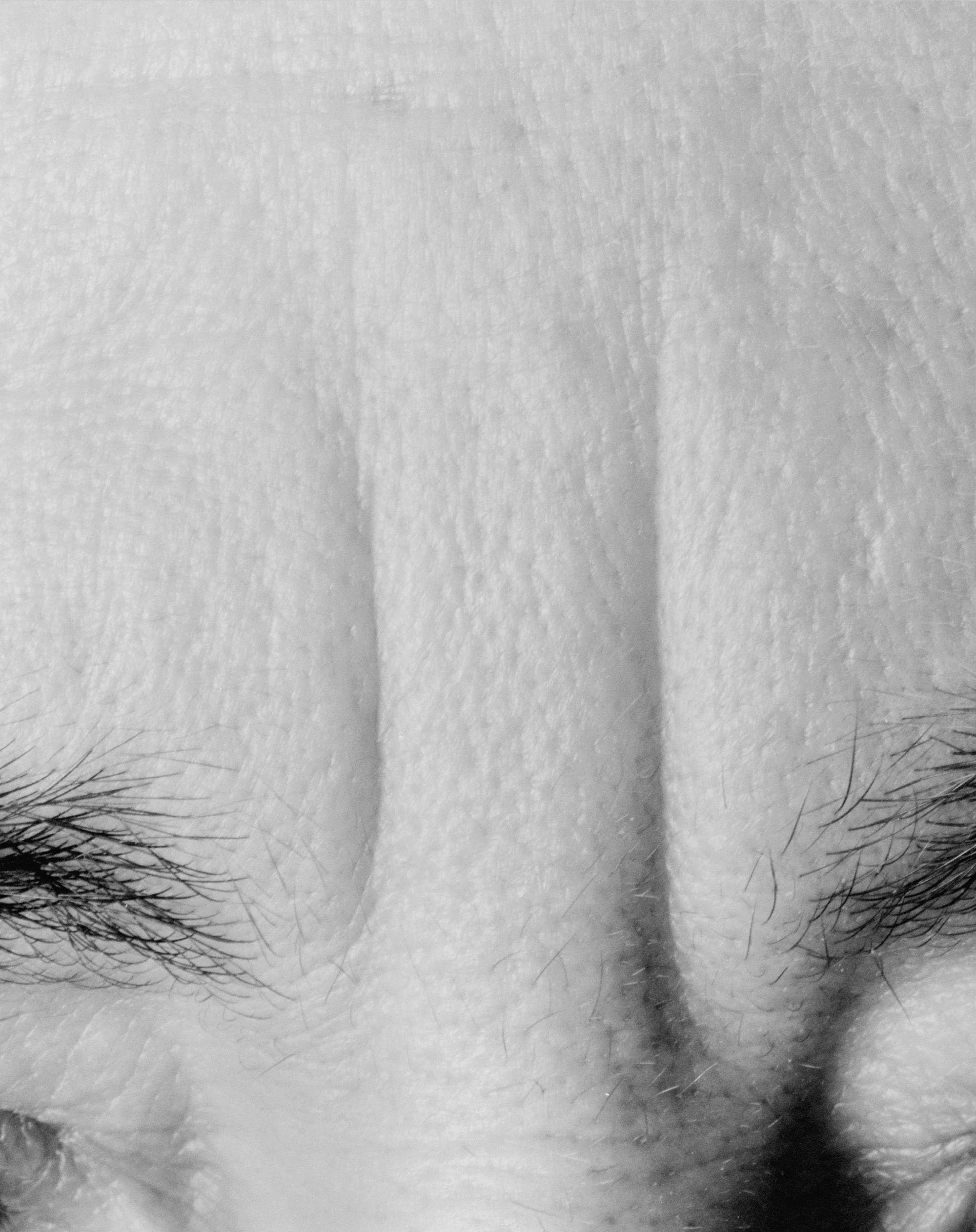 mom-forehead-1.jpg