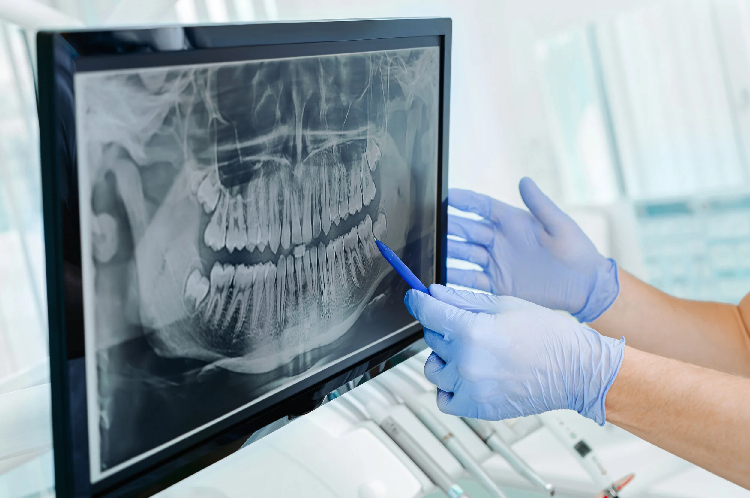 00xray.jpg