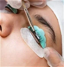 Een persoon ondergaat een wenkbrauwbehandeling waarbij een arts een pincet of pincet-achtig instrument gebruikt bij de oog- en wenkbrauwregio, met bescherming voor de ogen en een witte onderlaag.