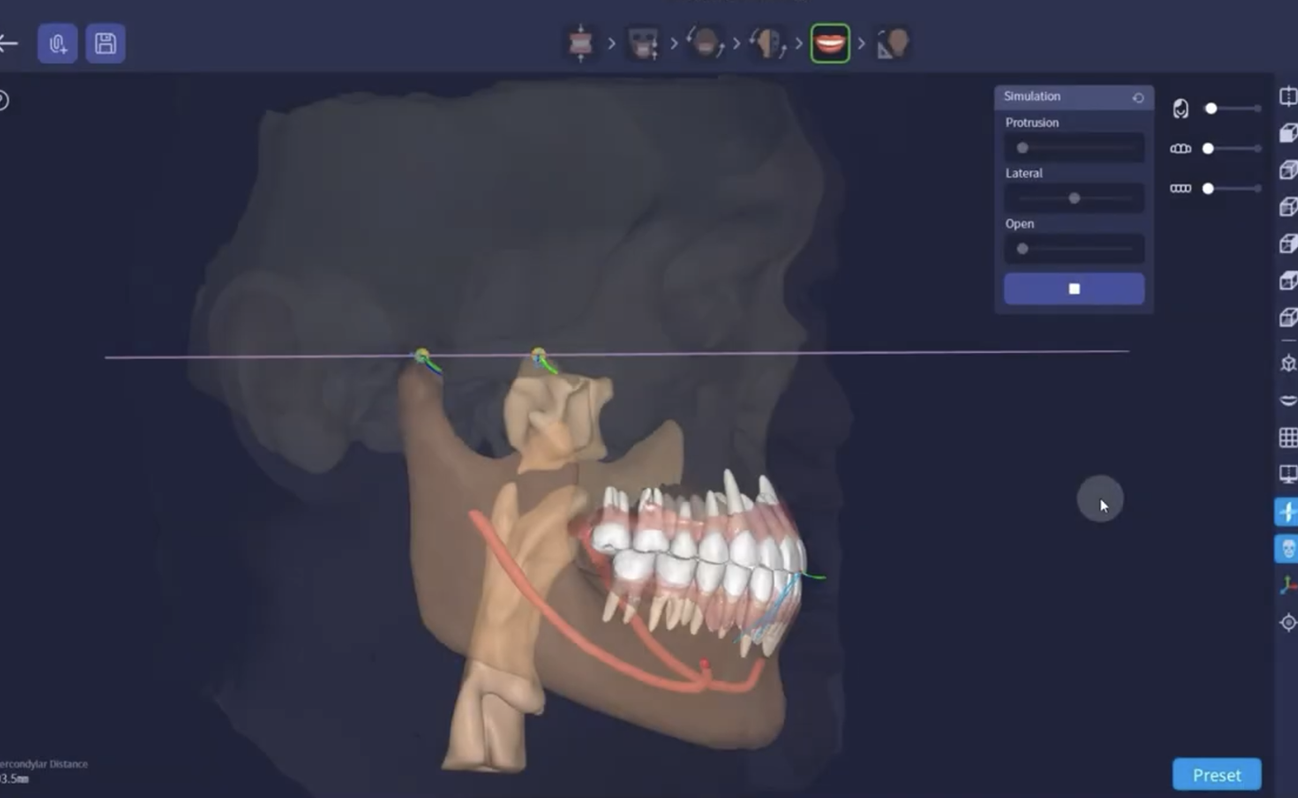 A dental X-ray displayed on a computer screen with a pop-up window for exporting the image in DICOM format, showing a panoramic view of a patient's teeth and jaw with dental work.