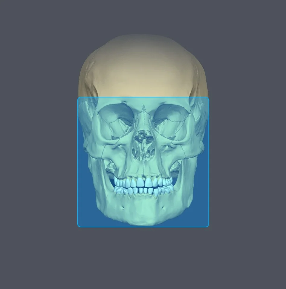 Digital rendering of a human skull from the front, with the upper part of the skull seen at the top and the face area highlighted in blue.