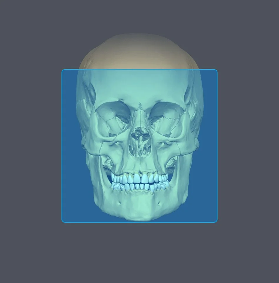 Digital 3D rendering of a human skull with visible facial bones and teeth, shown from the front on a gray background.