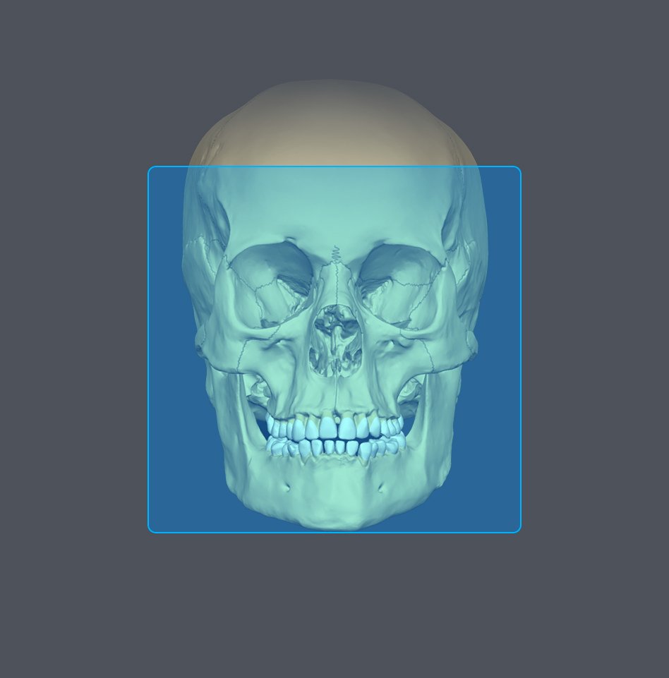 3D rendering of a human skull viewed from the front with a blue highlight box around the face.
