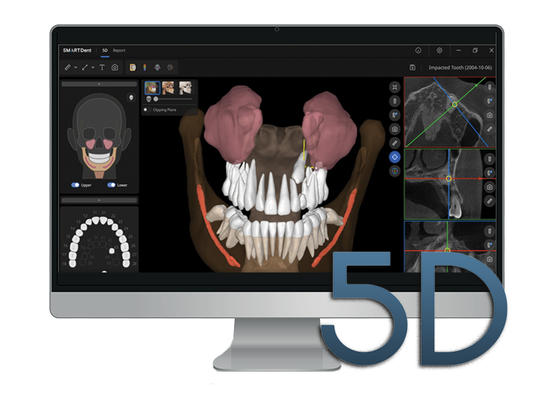 A computer screen displaying a 3D dental scan and modeling software for 5D imaging, showing detailed views of teeth, gums, and jaw structures.