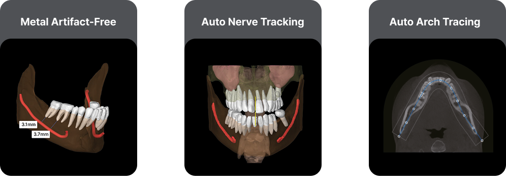 Three panels showing dental imaging processes: the first displaying a 3D dental model highlighting metal artifact-free areas, measurements, and dental implants; the second illustrating a 3D view of a complete set of teeth with nerve tracking lines; and the third showing a cross-sectional dental X-ray with automatically traced dental arch lines.