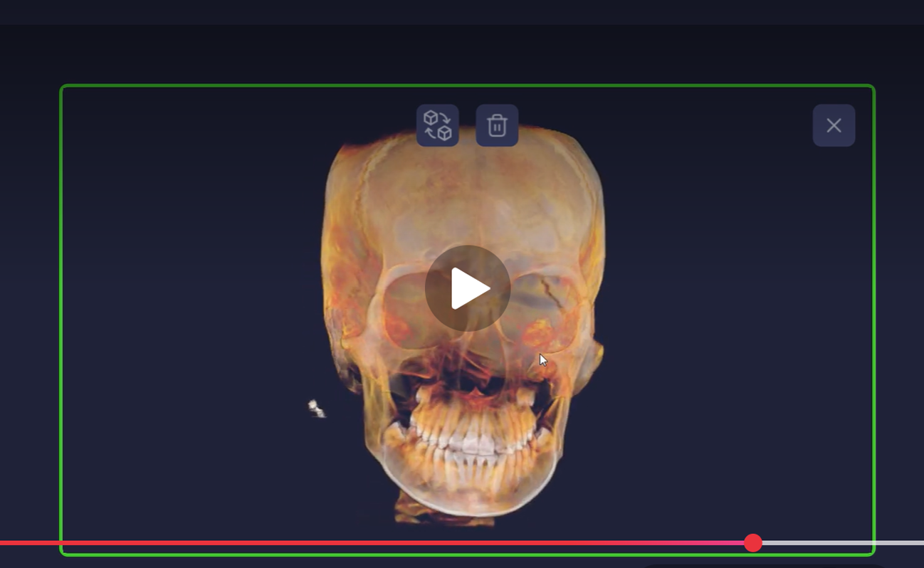 A dental X-ray displayed on a computer screen with a pop-up window for exporting the image in DICOM format, showing a panoramic view of a patient's teeth and jaw with dental work.