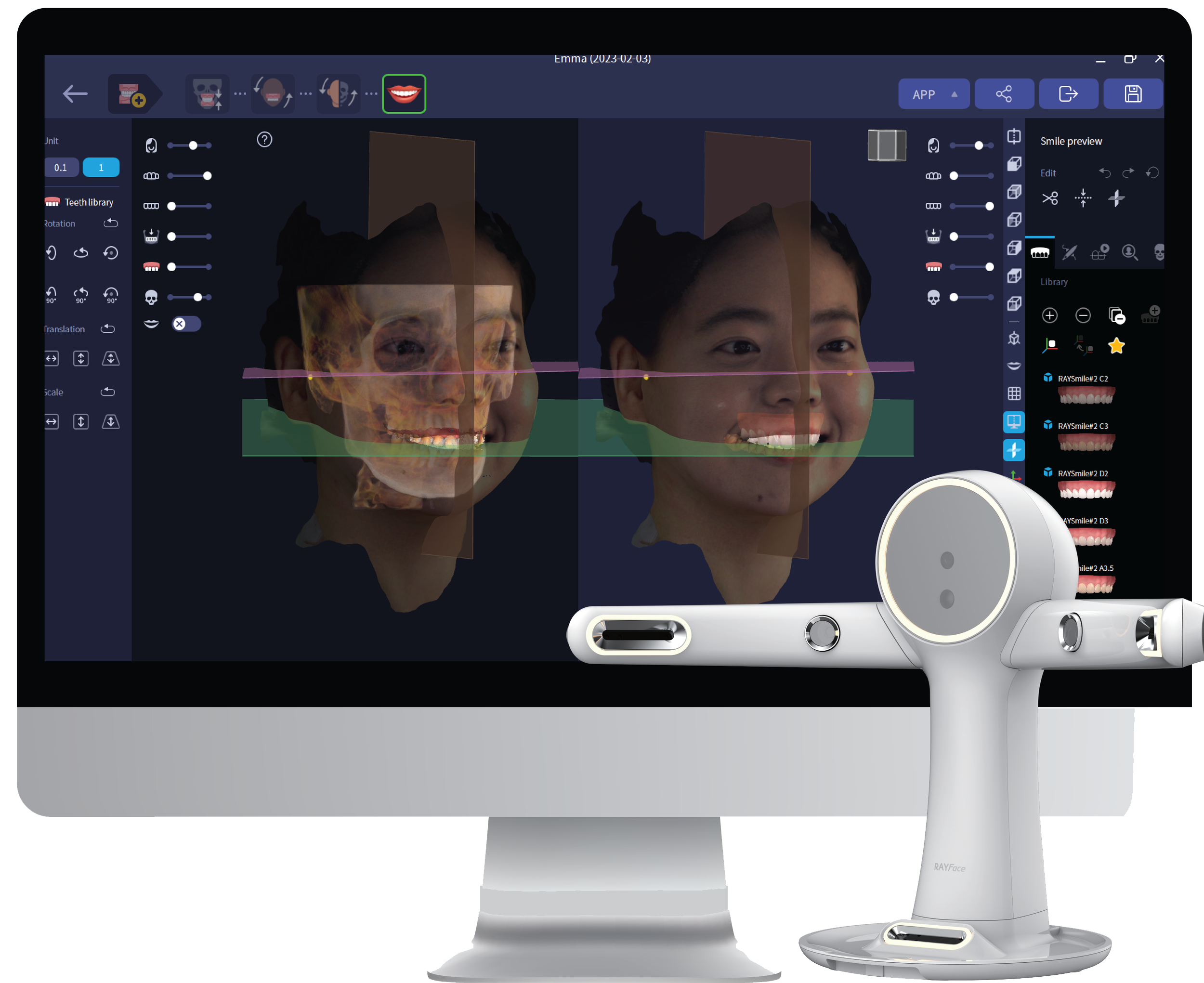 Screenshot of dental imaging software displaying X-ray images of a patient's skull and teeth, with the software name RealGUIDE Software visible.