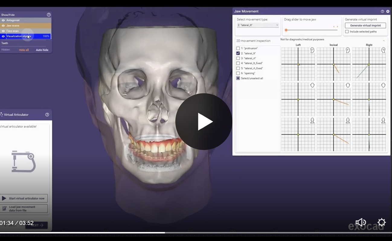 Screenshot of dental imaging software displaying X-ray images of a patient's skull and teeth, with the software name RealGUIDE Software visible.