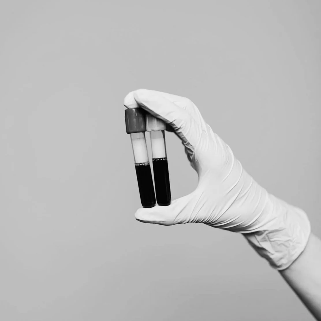 Lab Testing