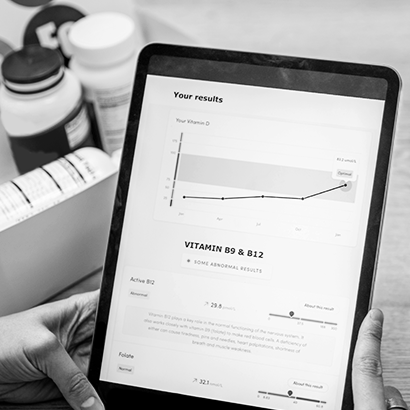 Nutritional Assessment - This in-depth nutritional physical exam evaluates subtle external signs of health, including the face, tongue, eyes, skin, nails, hair, scalp, and ears. Combined with Bio-Impedance Analysis and Heart Rate Variability testing,