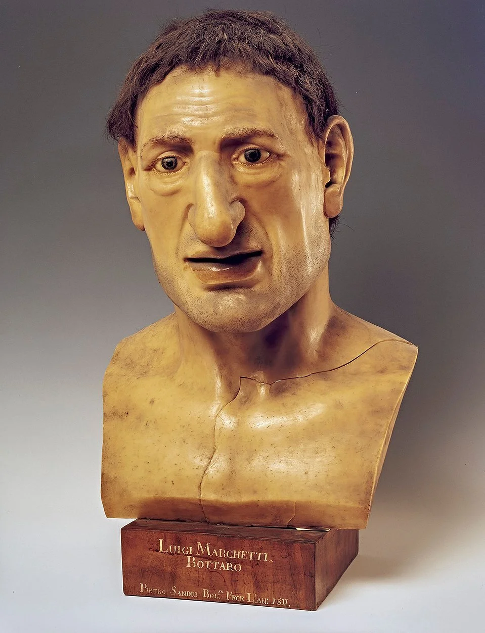 Scultura in cera del Bottaro, Museo di Anatomia Patologica di Bologna