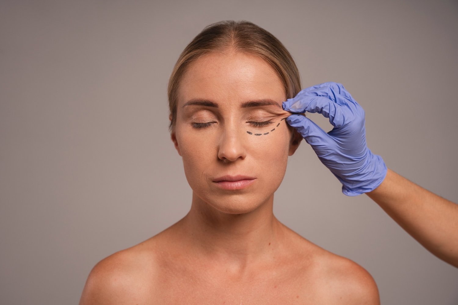 Blefaroplastia: como funciona a cirurgia das pálpebras e para quem é indicada