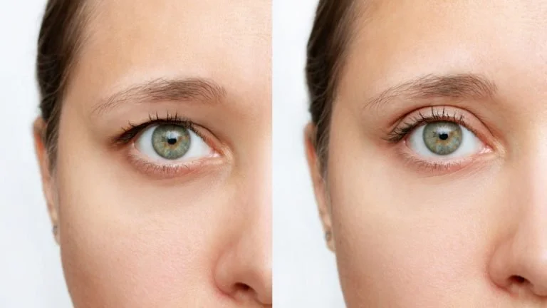 Antes e depois de uma maquiagem, focando na área dos olhos e pele ao redor