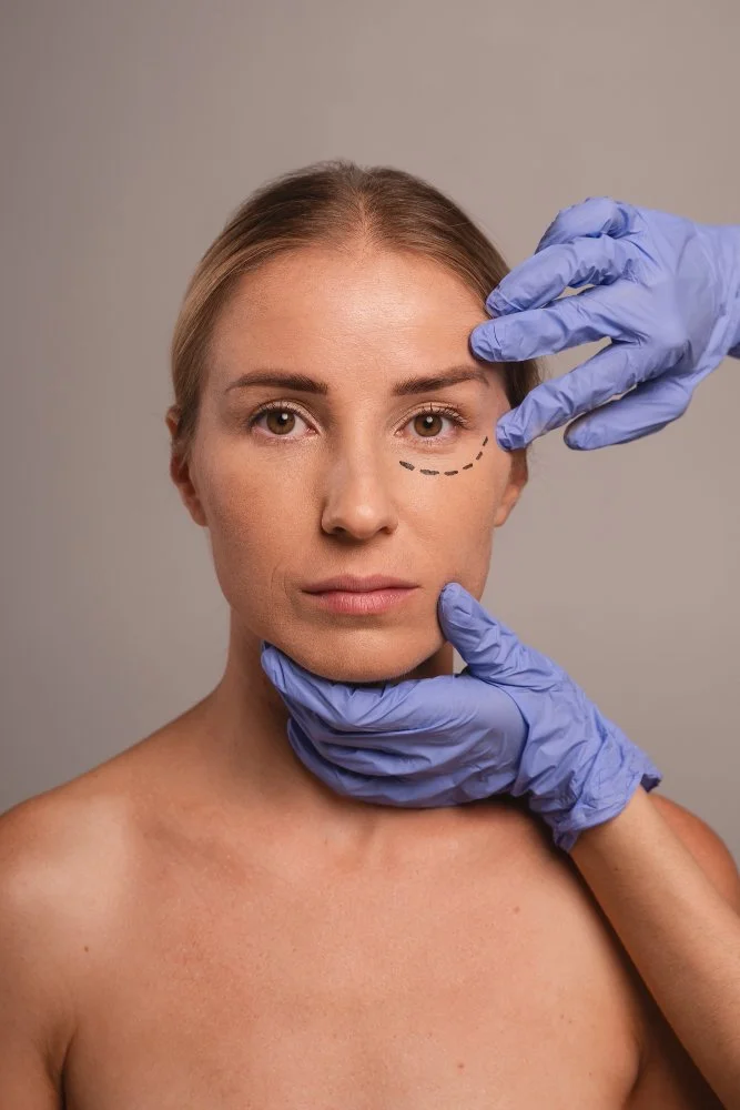 Mulher com expressão séria, sendo preparada para cirurgia plástica no rosto, com marca marcada na área ao redor do olho e mãos com luvas de procedimento médico segurando seu rosto.