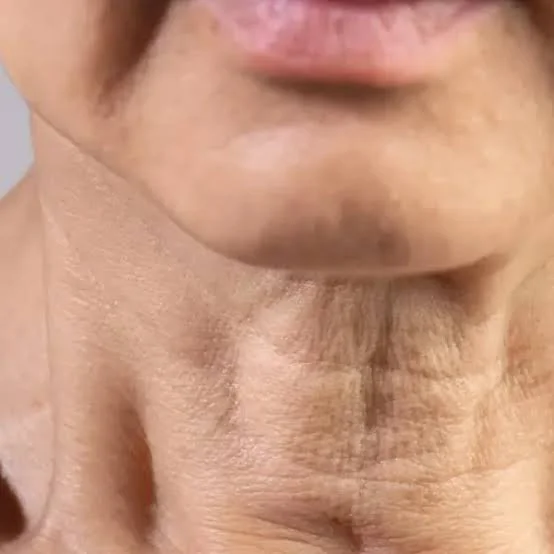 Um pescoço humano, de pele clara, com algumas rugas e sinais de envelhecimento.