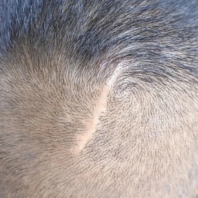 Close-up de cabelo com um corte militar, mostrando o couro cabeludo e o crescimento das madeixas.