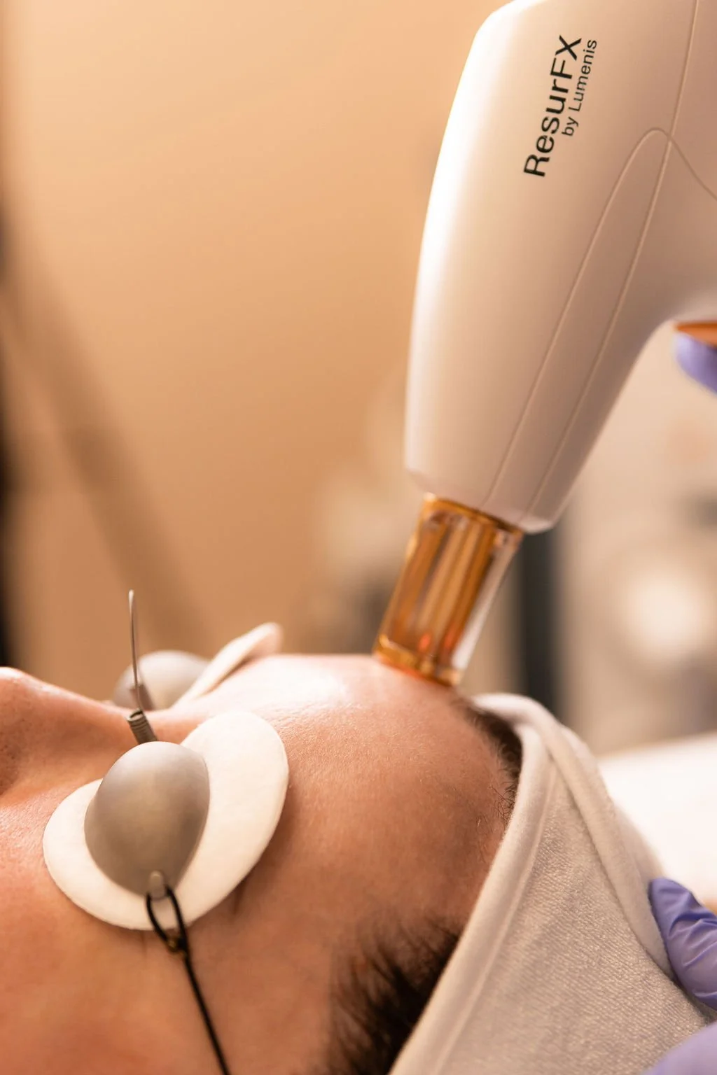 Procedimento de rejuvenescimento facial com laser, abordagem de luz intensa em um paciente deitado.