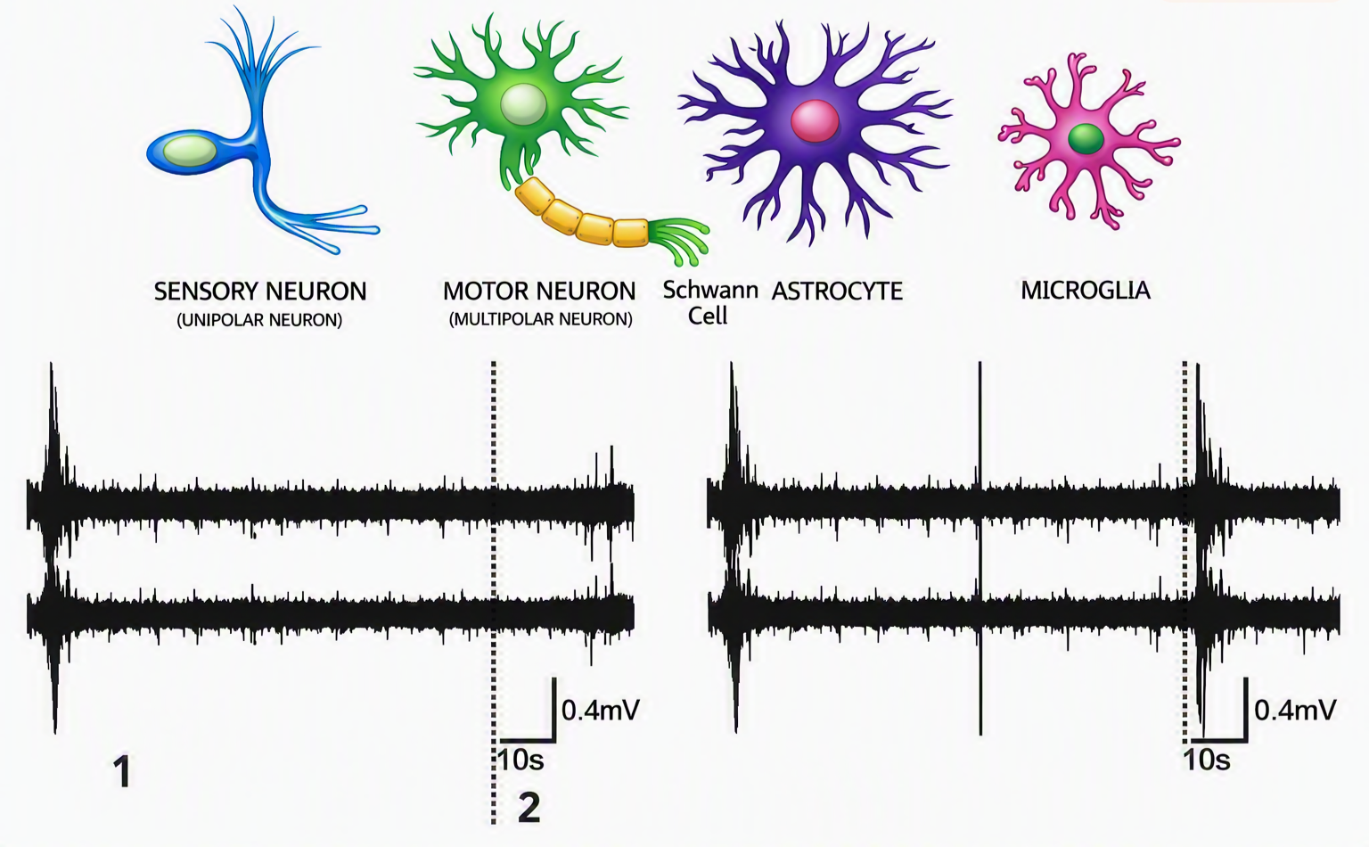 Diagram showing different types of brain cells, including sensory neuron, motor neuron, Schwann cell, and microglia, with their respective waveforms.
