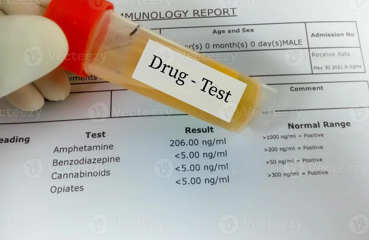 A drug test tube labeled 'Drug - Test' resting on a paper report showing test results for Amphetamine, Benzodiazepine, Cannabinoids, and Opiates with corresponding results and normal range indicators.