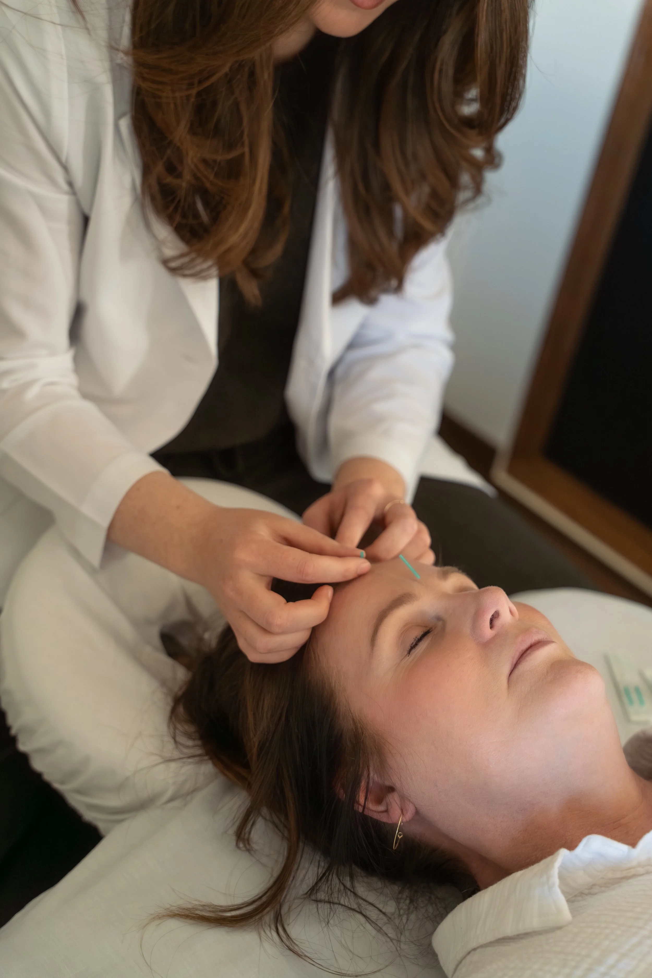 A woman is receiving acupuncture treatment while lying on a bed with her eyes closed. The acupuncturist is inserting thin needles into her face near her forehead at clinic in Lacombe Alberta.