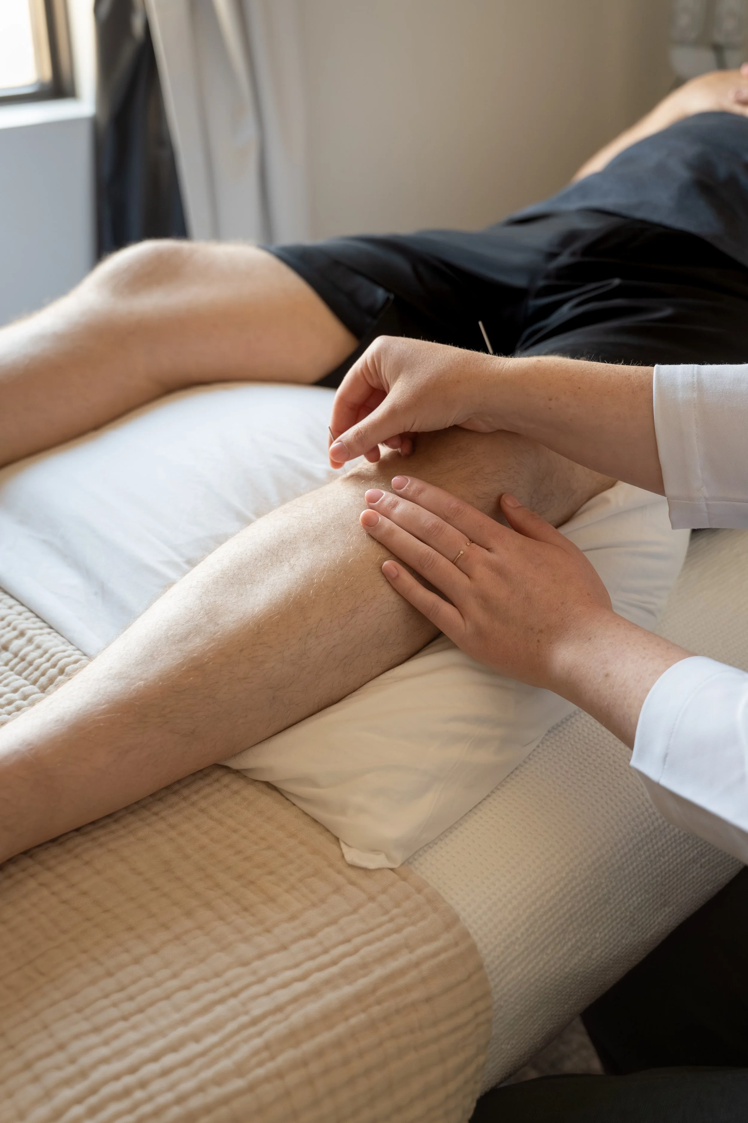A person receiving acupuncture on their leg in Traditional Chinese Medicine located in Lacombe Alberta