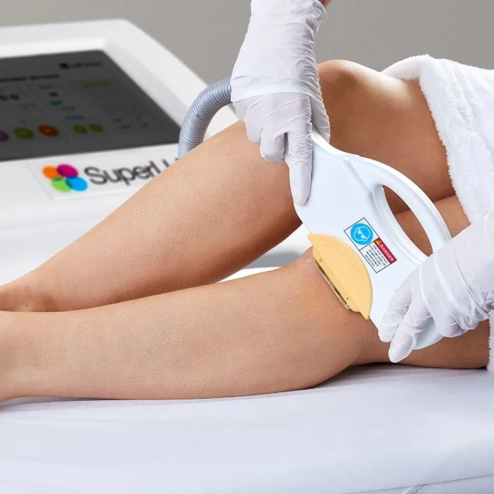 IPL hair reduction treatment in the Pilbara