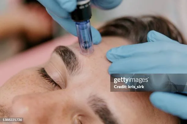 A person receiving a cosmetic treatment or injection on forehead, administered by a professional wearing blue gloves.