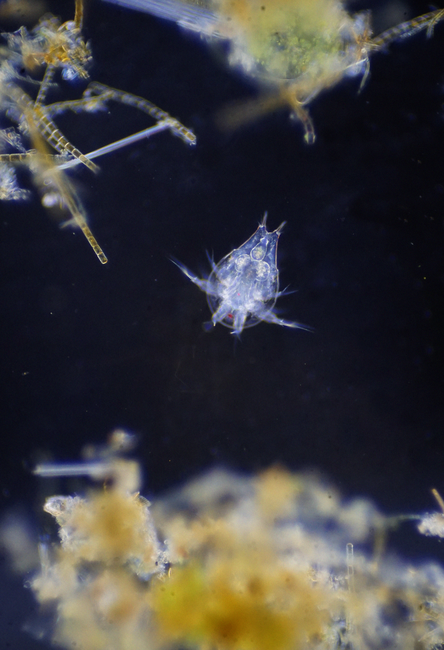 copepod_nauplius1_noise small.png