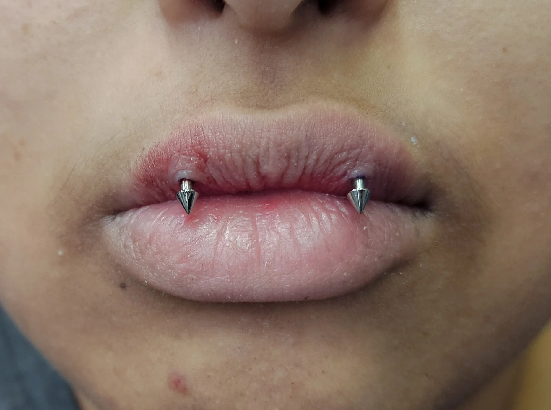 Close-up of a person's lips with two silver spikes piercings, one on each side of the lower lip.