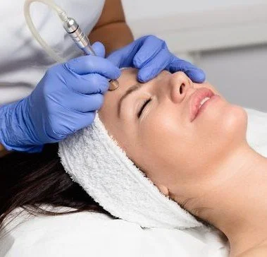 Microdermabrasion