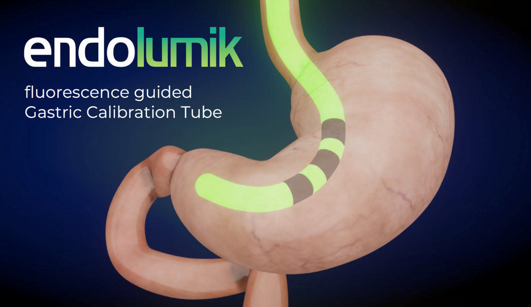 Endolumik- Minimally invasive surgical navigation aid.